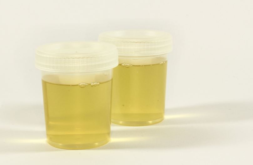 synthetic urine