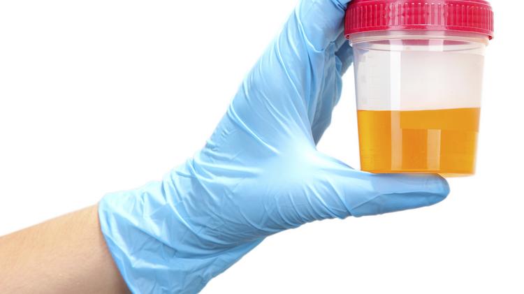 urine synthetic